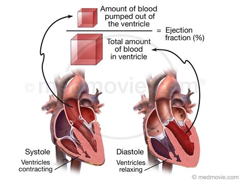 fraction of 27|ejection fraction 27.